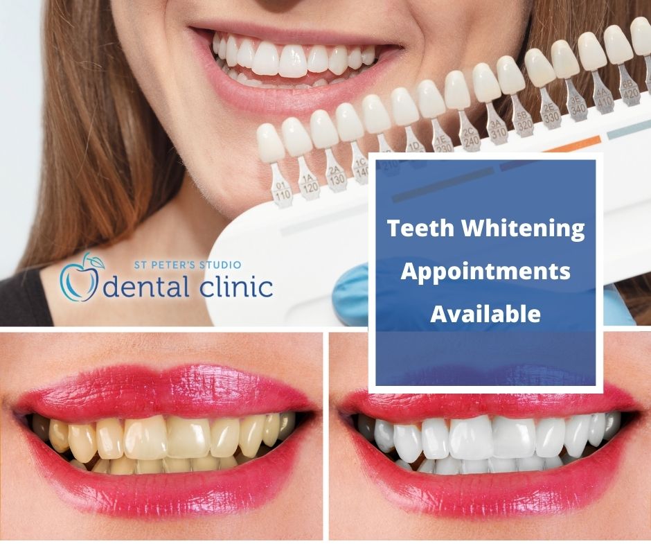 Teeth Whitening Appointments Available image